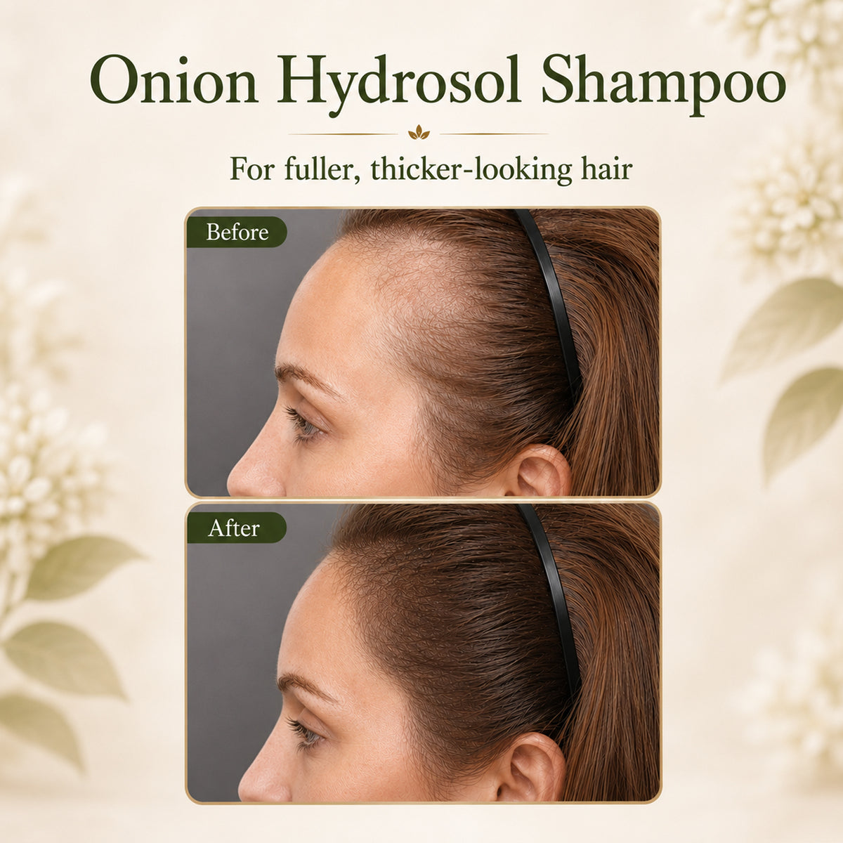 JLQJLQ Onion Hydrosol Shampoo